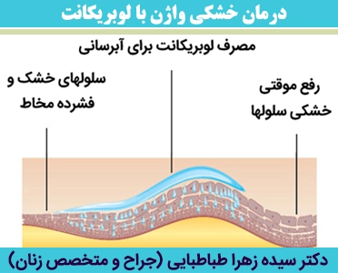 درمان-خشکی-واژن-با-لوبریکانت1