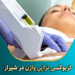 کربوکسی-تراپی-واژن-در-شیراز