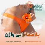 پلاسماتراپی واژن در شیراز