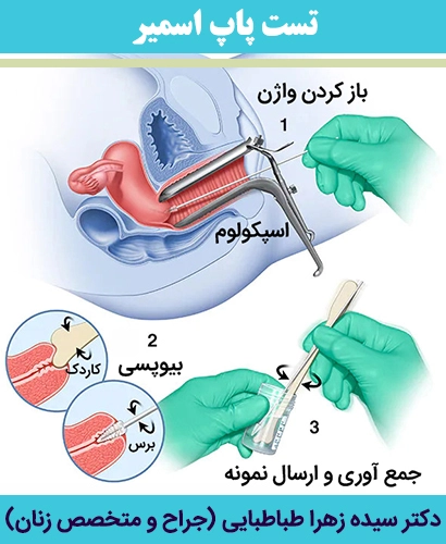تست-پاپ-اسمیر