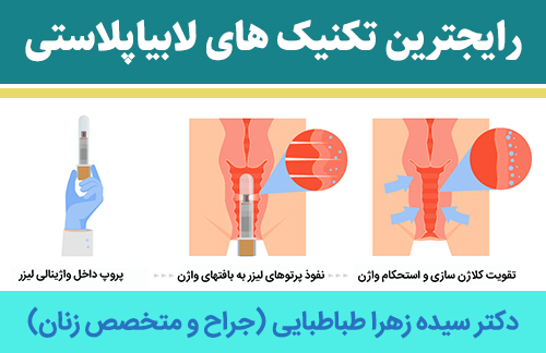 رایجترین-تکنیک-های-لابیاپلاستی