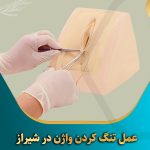عمل-تنگ-کردن-واژن-در-شیراز