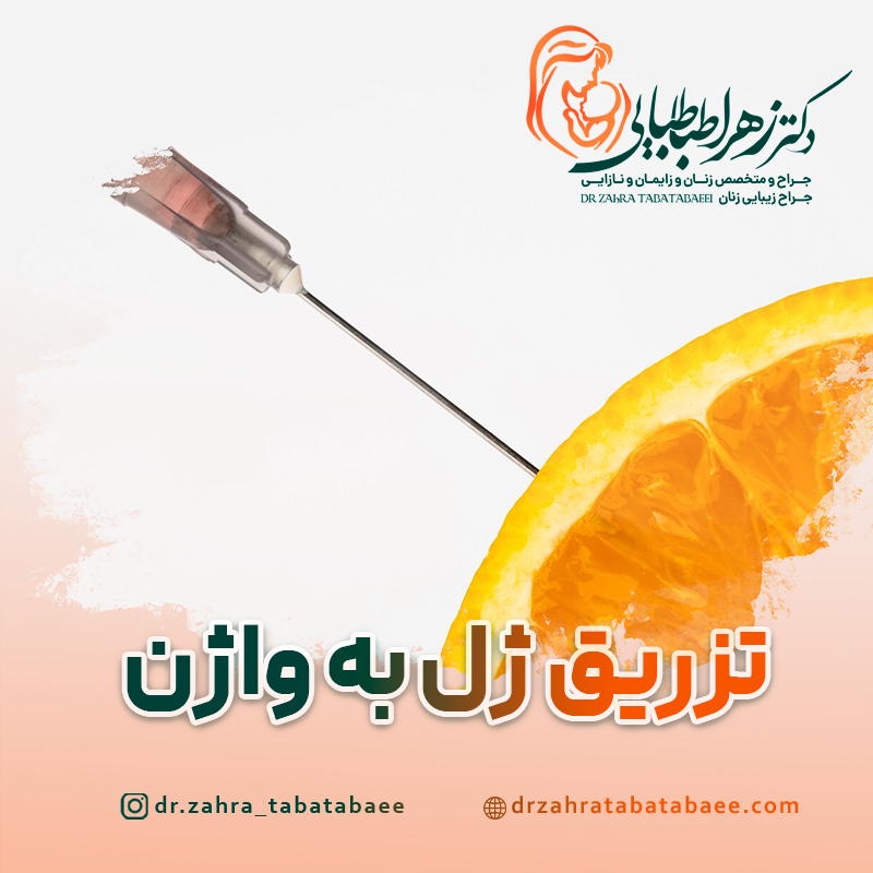 تزریق ژل به واژن در شیراز: مزایا – عوارض – ماندگاری