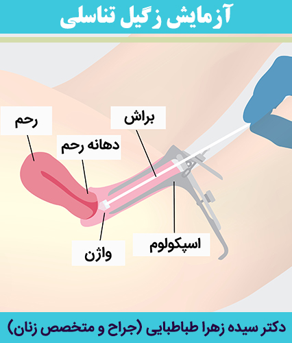 آزمایش-زگیل-تناسلی