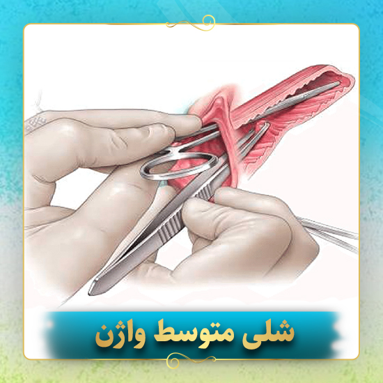 شلی-متوسط-واژن