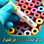 مرکز-تست-HPV-در-شیراز