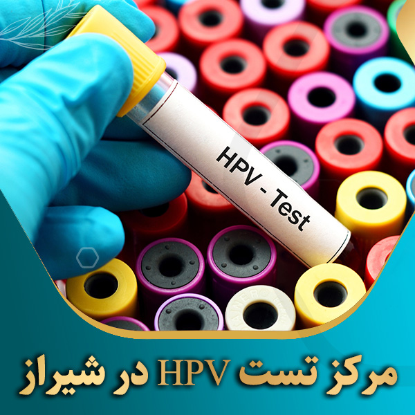 مرکز-تست-HPV-در-شیراز