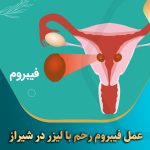 عمل-فیبروم-رحم-با-لیزر-در-شیراز