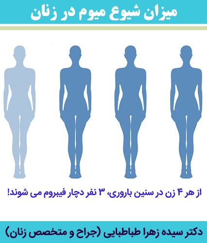 میزان-شیوع-میوم-در-زنان