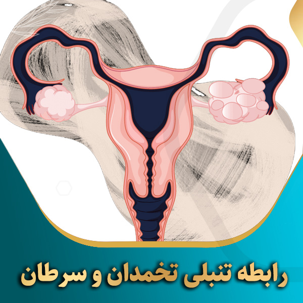 رابطه-تنبلی-تخمدان-و-سرطان