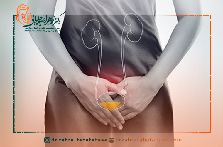 سوزش ادرار نشانه چیست؟