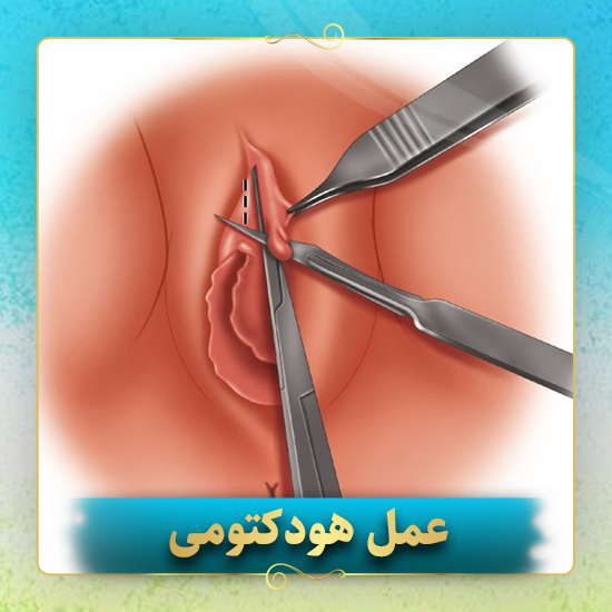 عمل-هودکتومی