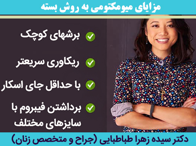 مزایای-میومکتومی-به-روش-بسته