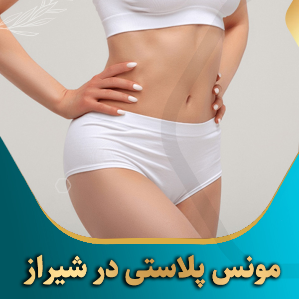 مونس-پلاستی-در-شیراز