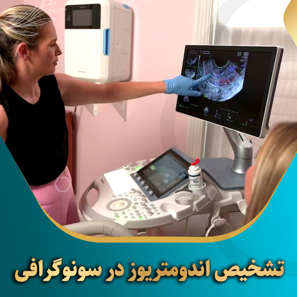 تشخیص-اندومتریوز-در-سونوگرافی