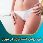 لیزر روشن کننده واژن در شیراز