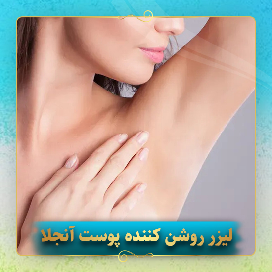 لیزر-روشن-کننده-پوست-آنجلا