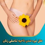 علل-تیره-شدن-ناحیه-تناسلی-زنان
