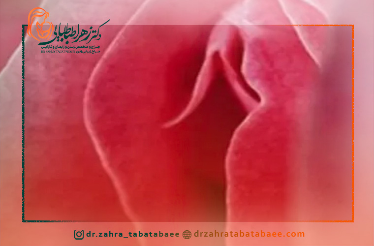 پرسش و پاسخ جراحی هودکتومی در شیراز