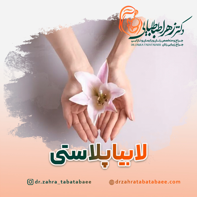 لابیاپلاستی در شیراز