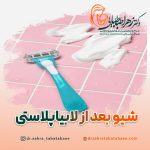 شیو کردن قبل از لابیاپلاستی