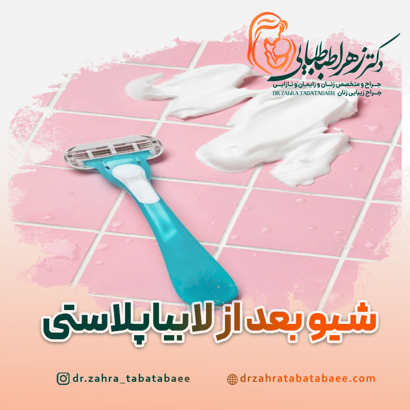 شیو کردن قبل از لابیاپلاستی