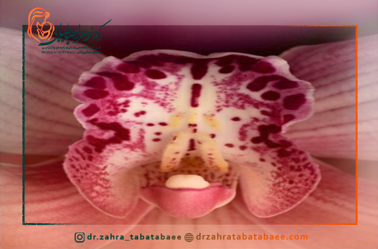 استفاده از دارو برای رفع تورم ایجاد شده بعد از عمل لابیاپلاستی