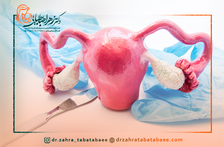 روشهای جراحی فیبروم رحم در شیراز