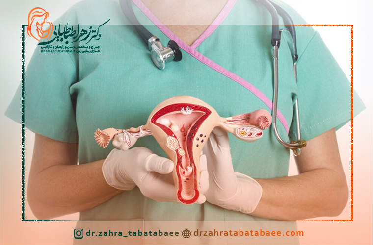روشهای درمان قطعی فیبروم رحمی در شیراز