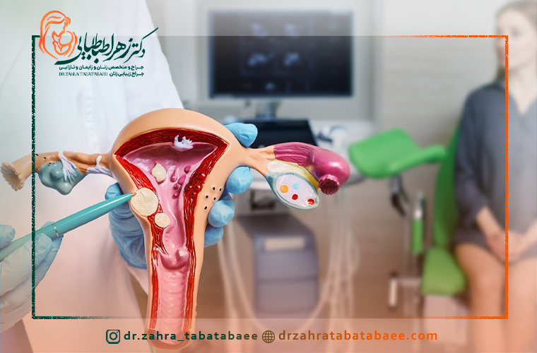 فیبروم یا میوم رحم چیست؟