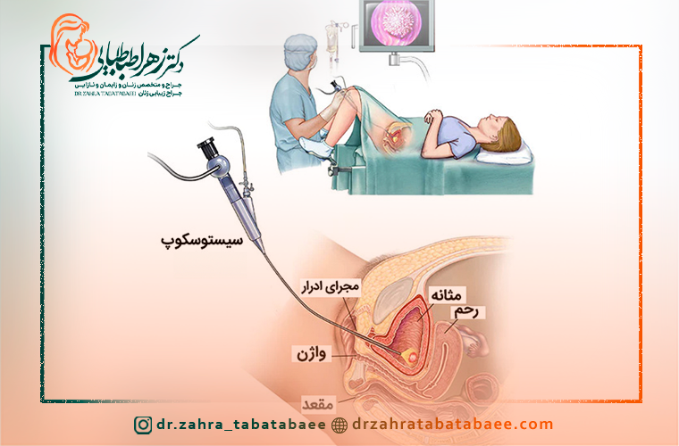 نحوه تشخیص عفونت ادراری زنان در شیراز