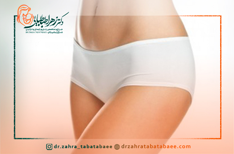 جلوگیری از افزایش تورم و رفع سریع آن بعد از لابیاپلاستی