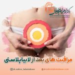 مراقبت های بعد از لابیاپلاستی