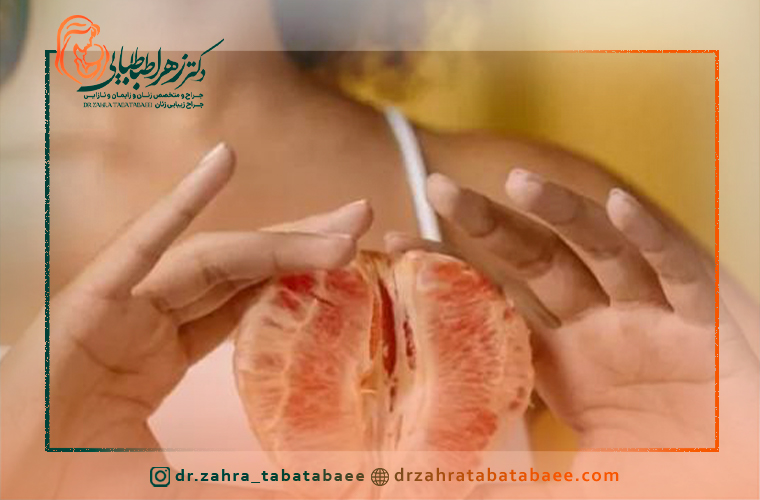 هزینه درمان چروک و شل شدگی واژن