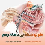 کولپوسکوپی دهانه رحم