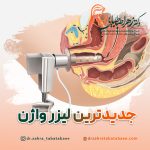 جدیدترین لیزر واژن در شیراز + هزینه لیزر واژینال