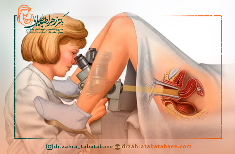 دلایل تجویز کولپوسکوپی توسط پزشک