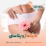 جراحی لابیاماژوپلاستی