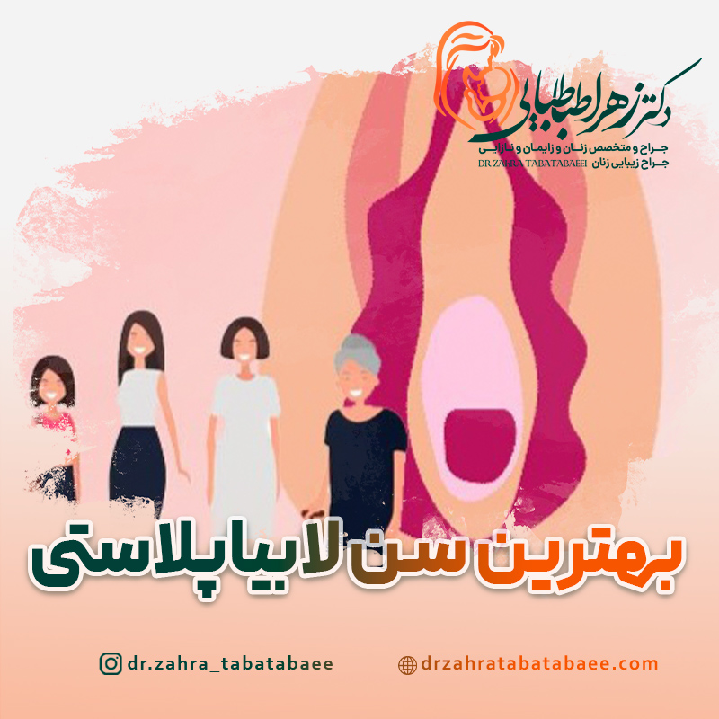 بهترین سن برای لابیاپلاستی