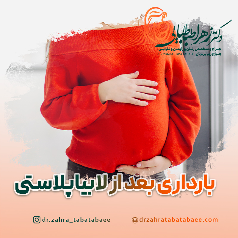 بارداری بعد از لابیاپلاستی